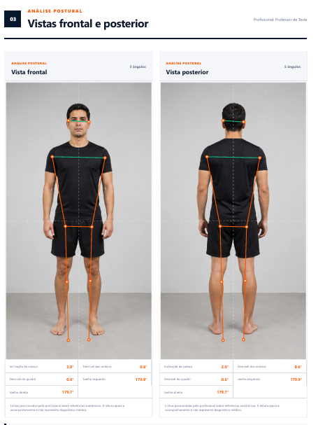 Exemplo demonstrativo de análise postural frontal e posterior