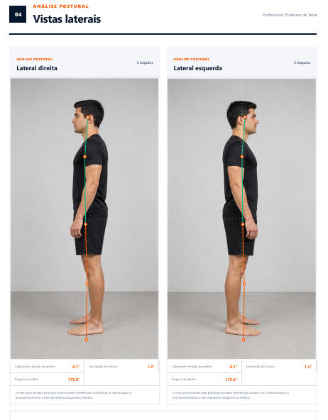 Exemplo demonstrativo de análise postural nas vistas laterais